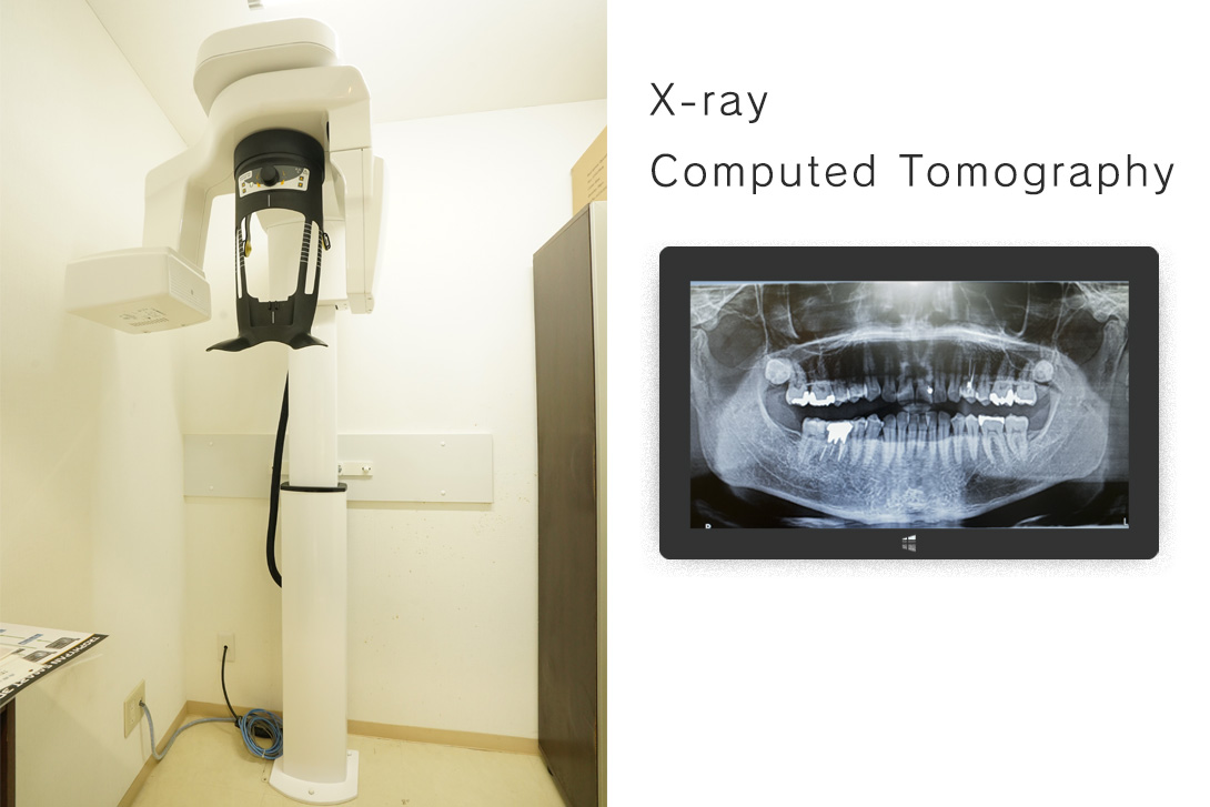 CTレントゲン・相模原駅ビル歯科