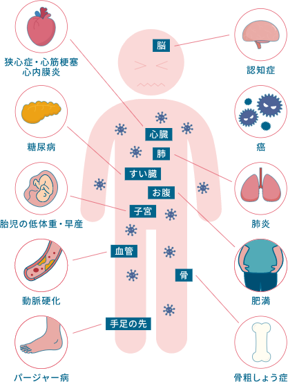 歯周病は生活習慣病の危険因子｜相模原駅ビル歯科