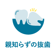 親知らず抜歯｜相模原駅ビル歯科・セレオ相模原２階
