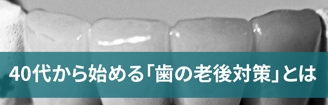 40代から始める歯の老後対策